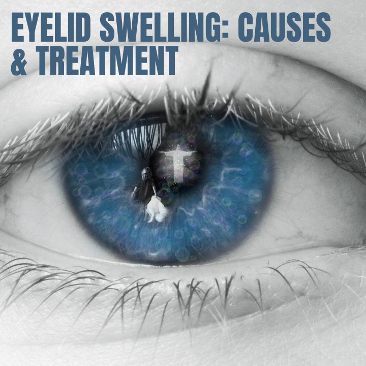 eyelid swelling