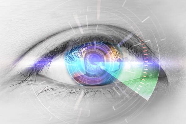 ICL vs LASIK