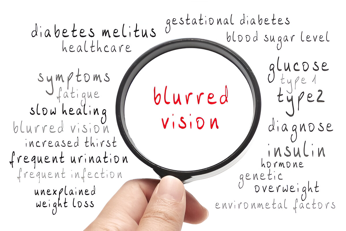 Can Dry Eyes Cause Blurred Vision